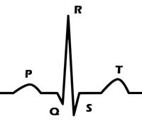 ECG waveform