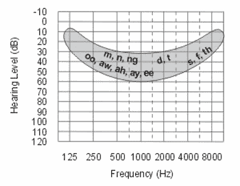sound audiogram