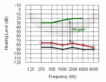 Target hearing level