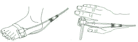 Recommended measuring method